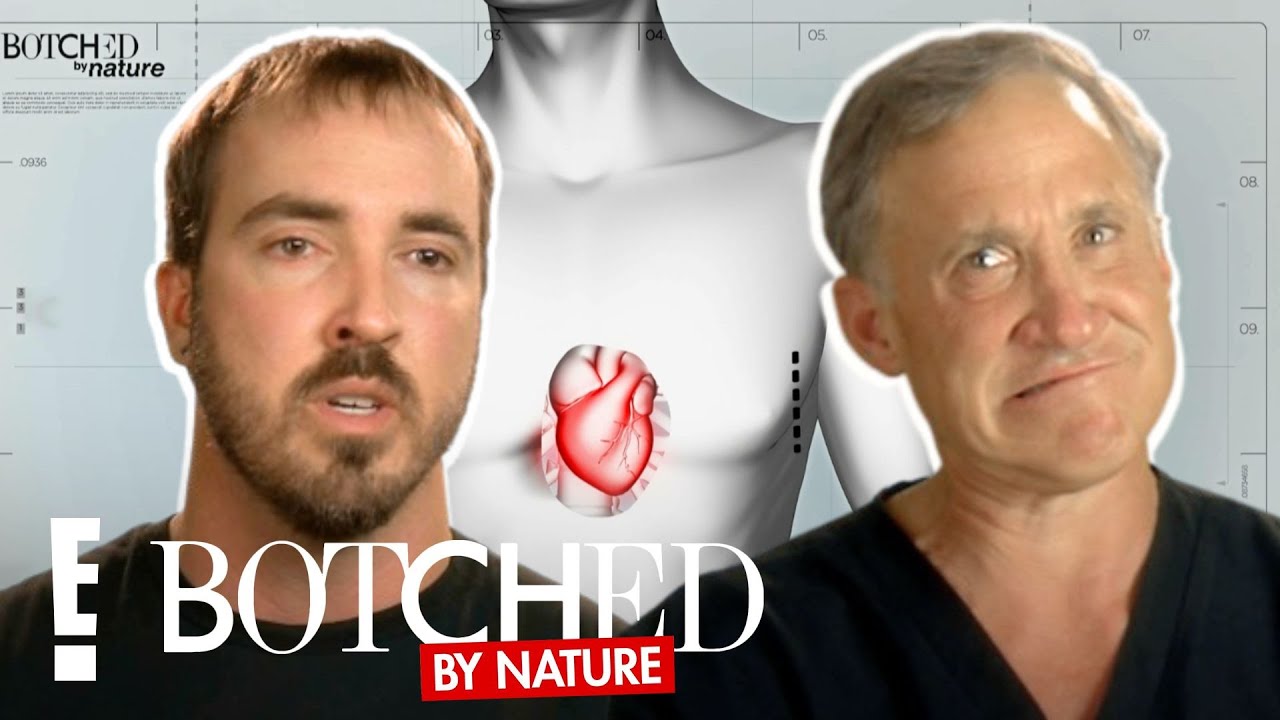 Проблемы с пузырями в груди Брэндона ПОЛНАЯ ТРАНСФОРМАЦИЯ | Botched By Nature | E!