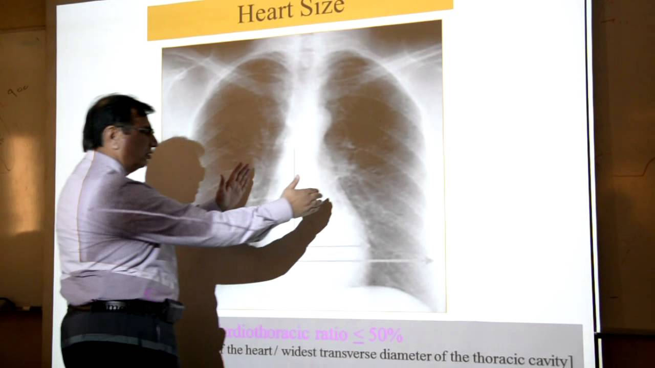 CSKL.[Radiology].Dr.Mahboob.CXR By Silver-R
