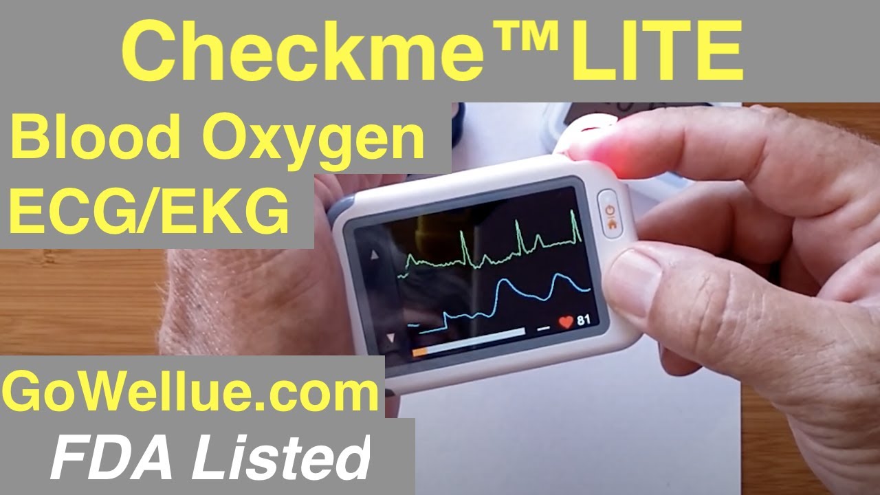 Wellue Checkme™LITE Heart Rate, ECG, SpO2, FDA Listed Medical Grade Device: Unboxing & 1st Look