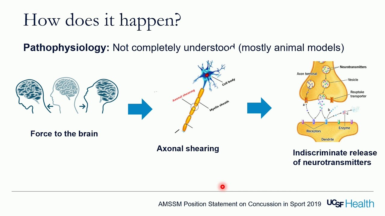Key Updates in Management of Youth Concussion - Nick Hatamiya, DO