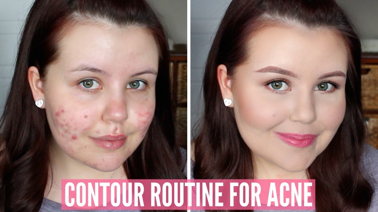 HOW TO HIGHLIGHT/CONTOUR TEXTURED SKIN | Acne, Scarring, Pores, etc.