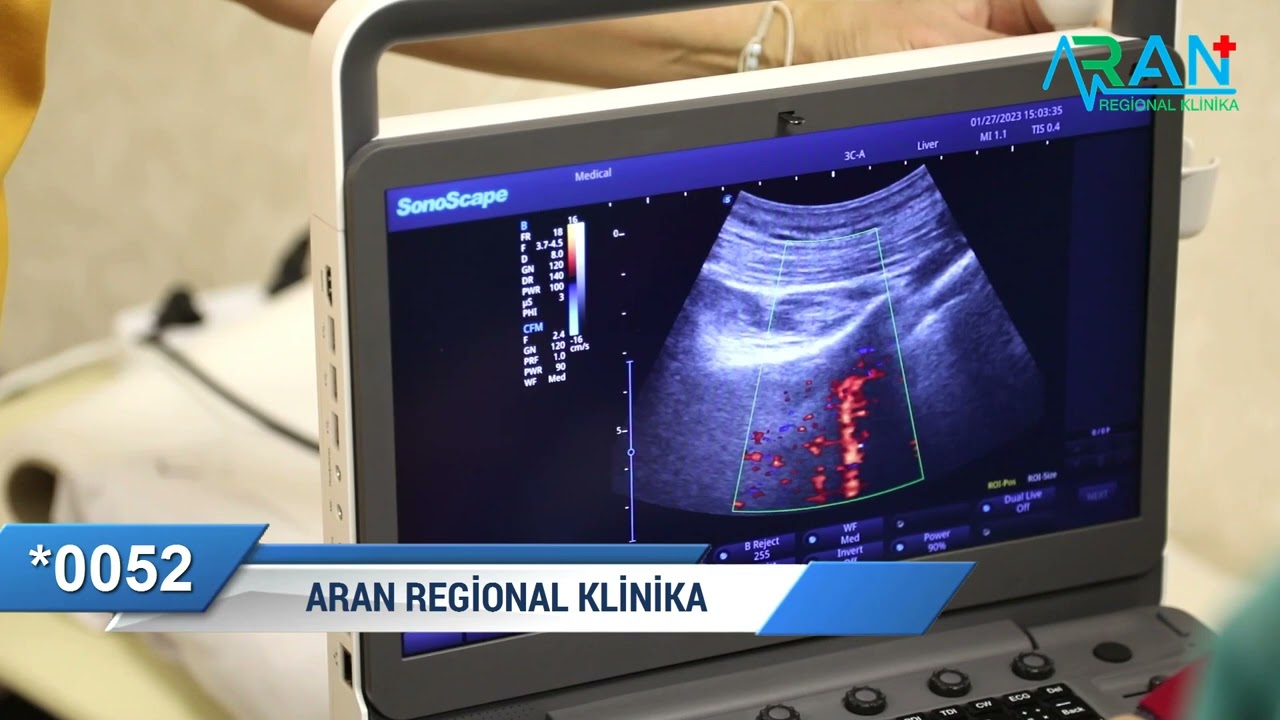 &nbsp; Yandal Uzmanı &mdash;​ Alqoloq​ Dr. Şahin Əzizov​&nbsp;Aran Regional klinika