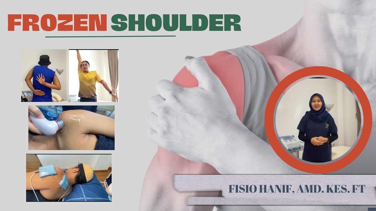 FROZEN SHOULDER, Bahu Kaku | Penyebab, Gejala dan Tindakan Fisioterapi