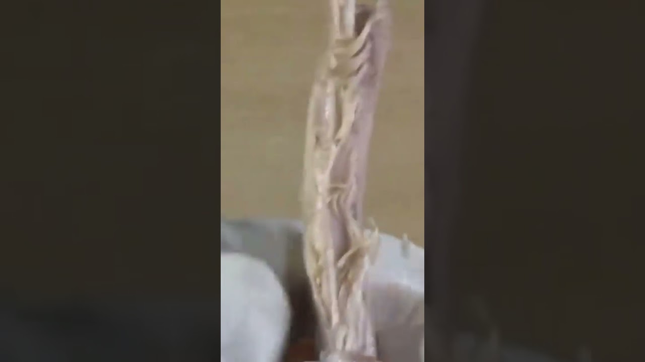 spinal nerves