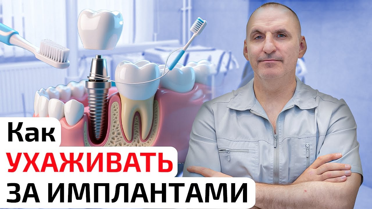 Как ухаживать за имплантами, чтобы они служили вечно?
