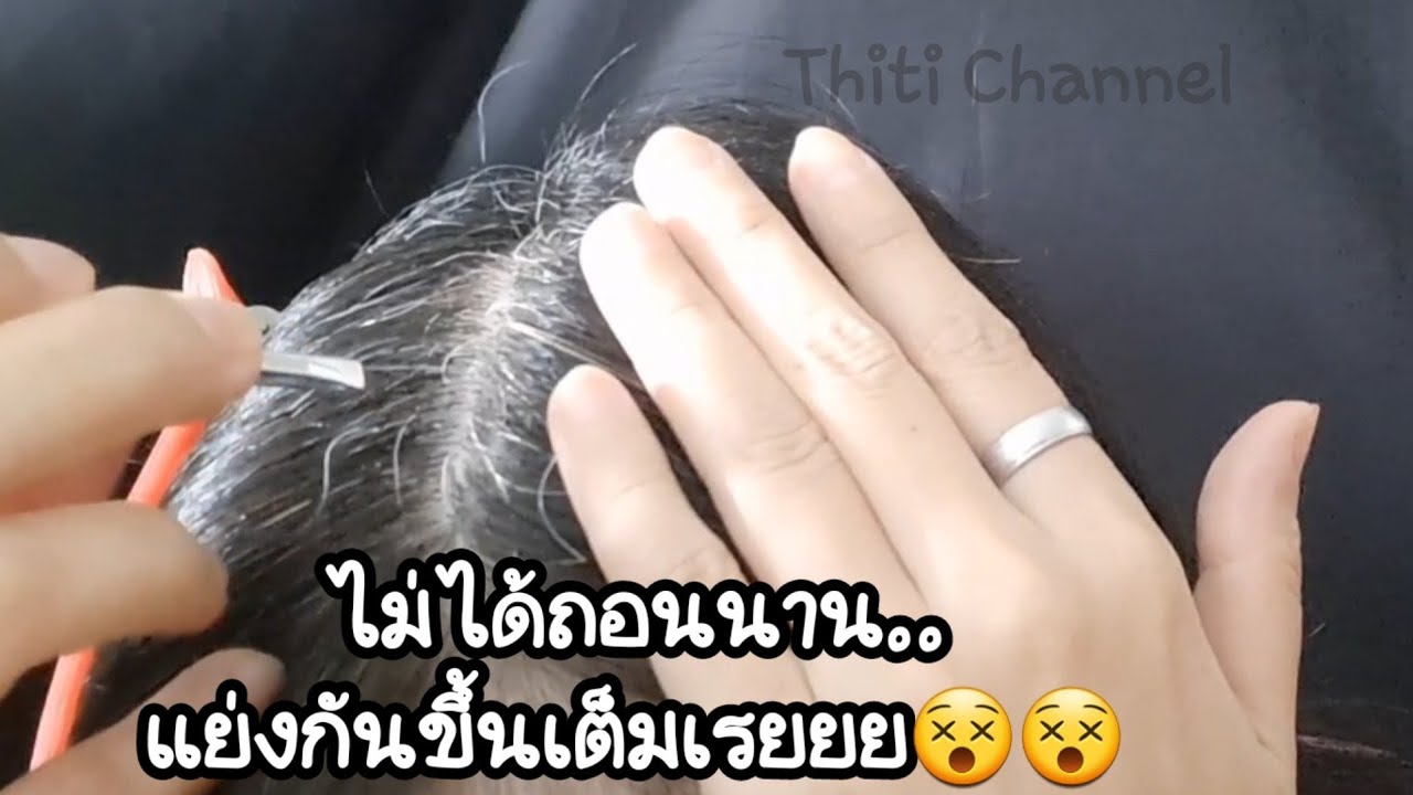 @ThitiChannel ถอนผมหงอกเอง เยอะจัด!! แย่งกันขึ้นเต็มเรยยย😱😱