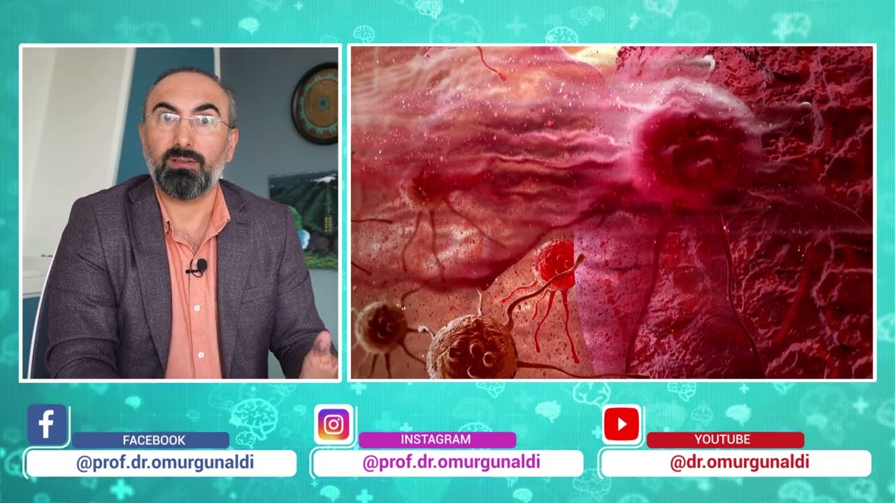 Glioblastoma Multiforme nedir? Belirtileri ve tedavi süreci nasıl olur?