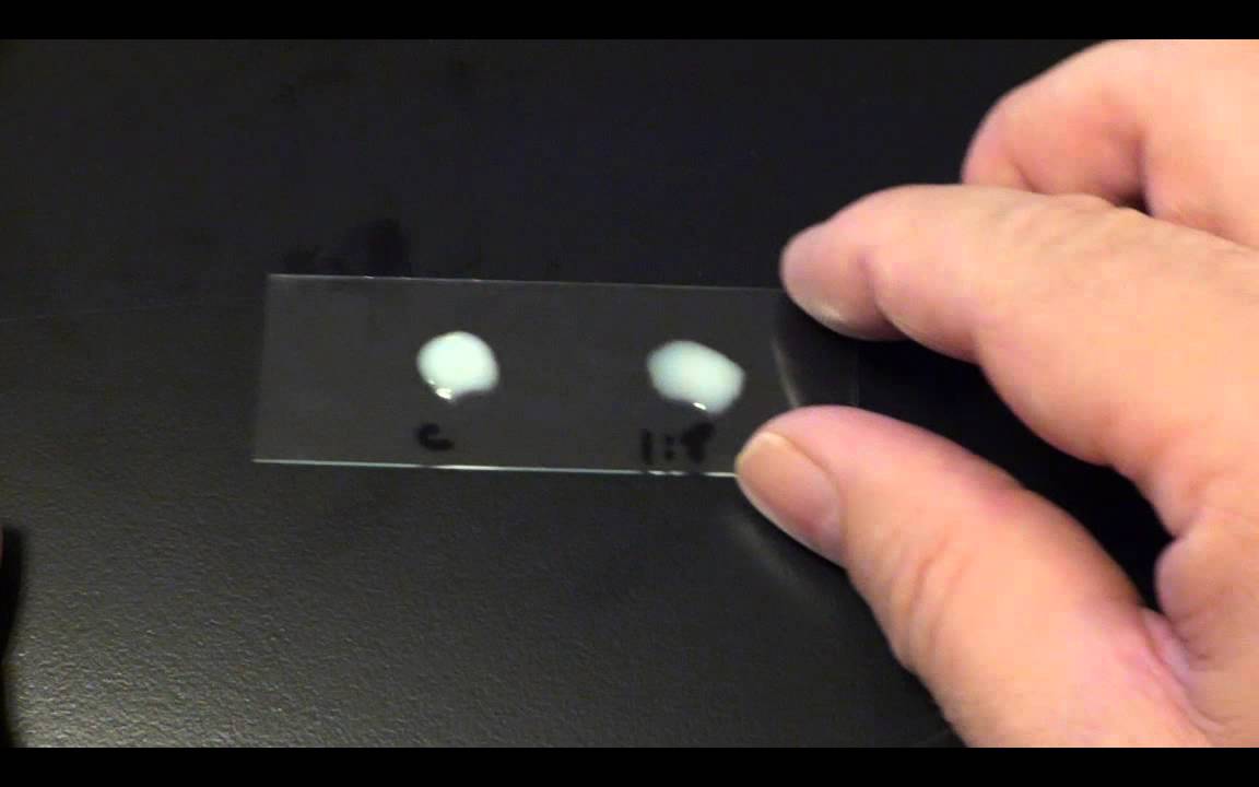 Diagnostic testing for infectious mononucleosis