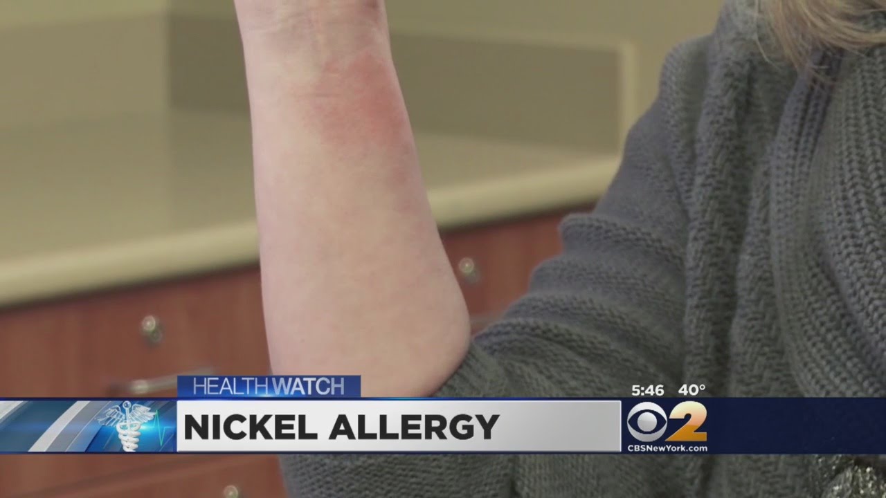 Dr. Max Gomez: Nickel Allergy