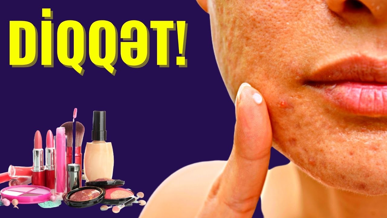 Что вызывает пятна и шрамы на лице? - Есть ли полное лазерное лечение?