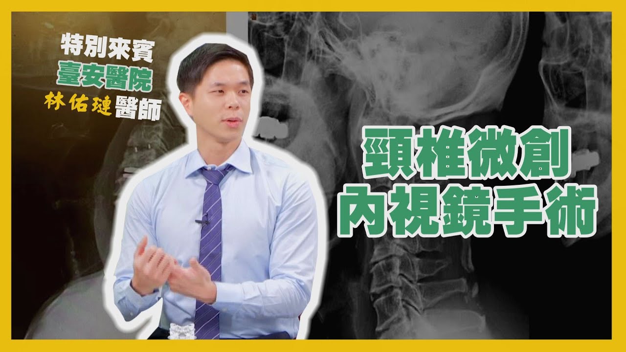健康新知2022 - 頸椎微創內視鏡手術