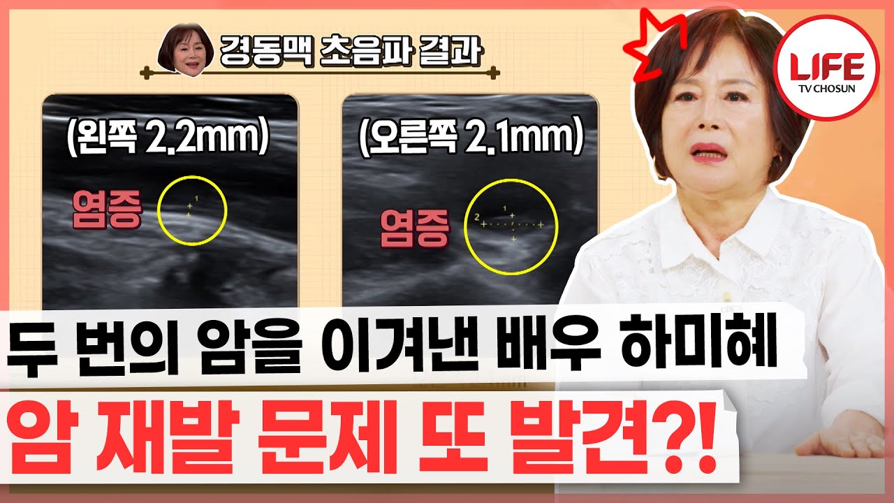 [#건강면세점] 유방암 투병 후 완치했지만 곧이어 찾아온 갑상샘암, 두 번의 암을 극복한 배우 하미혜가 매일 아침마다 하는 습관 (TV CHOSUN 231112 방송)