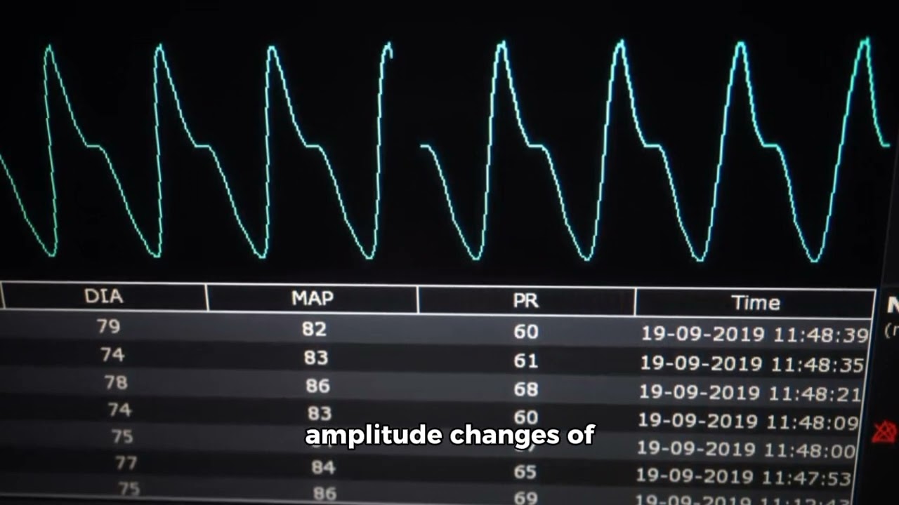 Why the output detector changes with variations in the audio frequency