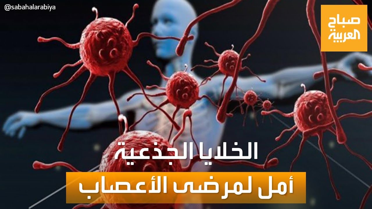 معجزة الطب.. علاج الخلايا الجذعية يعيد الأمل لمرضى الأعصاب