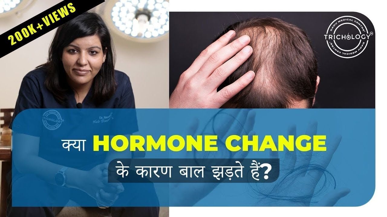 Discover the Hidden Pattern Behind Hormonal Hair Loss