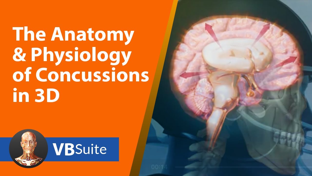 The Anatomy & Physiology of Concussions in 3D