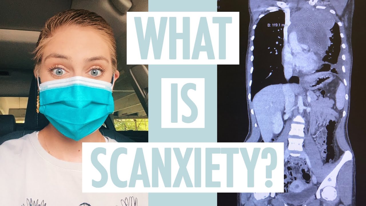WHAT IS SCANXIETY? | personal experiences & how I've dealt with it
