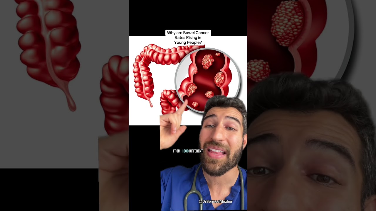 Why Are Bowel Cancer Rates Rising in Young People? #breakthrough