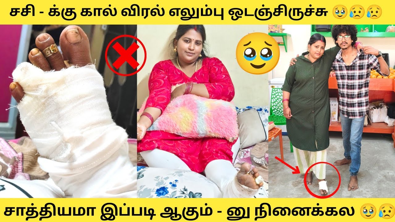 சசி - க்கு கால் எலும்பு 🥹 இப்படி ஆகும்னு நினைக்கல 😥 Orange Mittai 