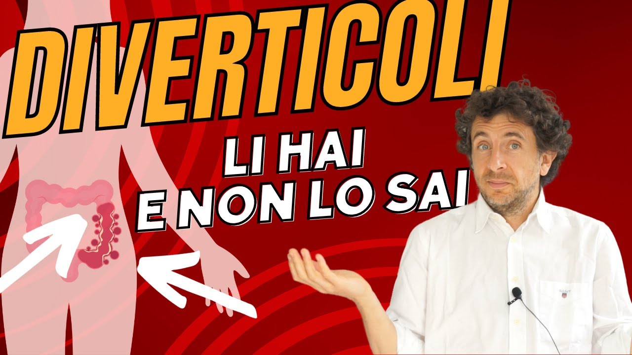 DIVERTICOLI: cosa sono, sintomi, dieta ideale e rischi di diverticolite