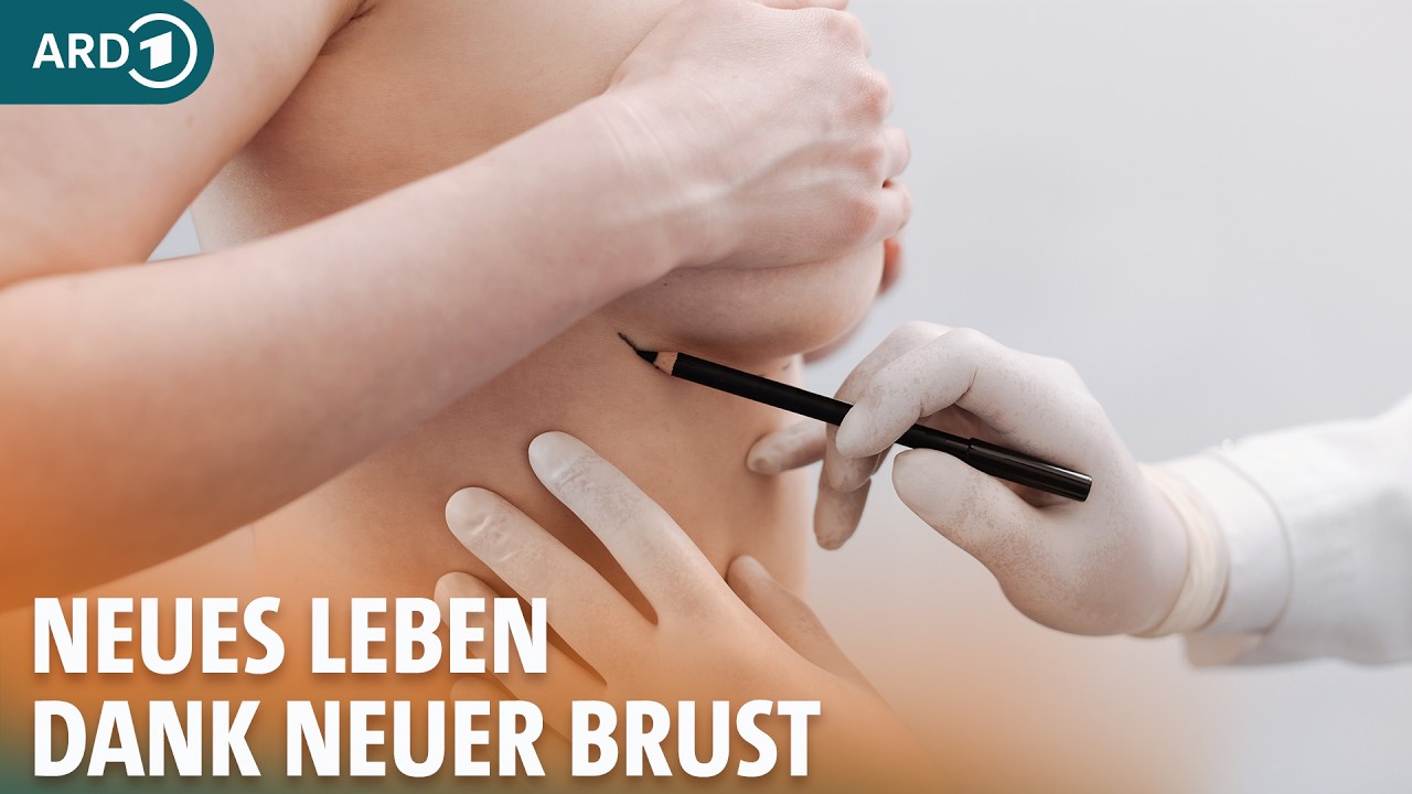 Rekonstruktion nach Brustkrebs: Alexandras Weg zu mehr Wohlbefinden I ARD Gesund