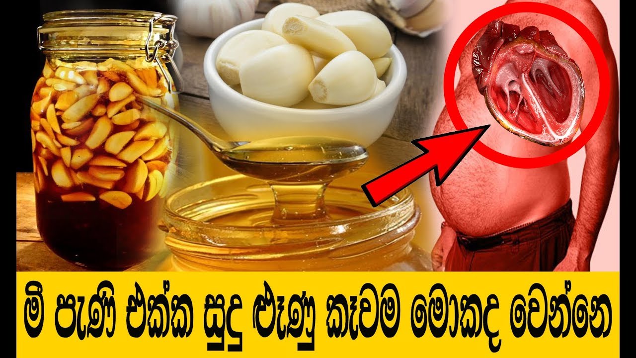 මී පැණි එක්ක සුදු ළුෑණු කෑවම අවුරුදු 100 ඉන්න පුලුවන්ද  | Sudulunu Mee pani  | Garlic and Honey