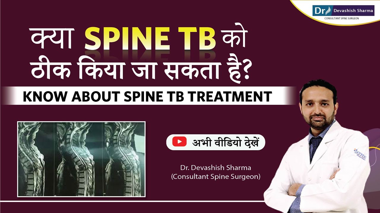 Can TB Spine Be Cured? Spine TB Treatment in Noida & Delhi | Spine TB Symptoms - Dr Devashish Sharma