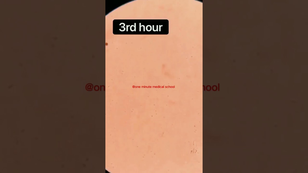 Sperm Analysis#book #doctor #motivation #quotes #study #brain #mbbs