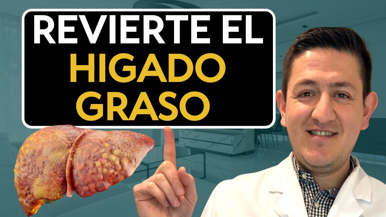 Hígado Graso QUE lo causa y COMO se REVIERTE Dr. Antonio Cota Sugar Care