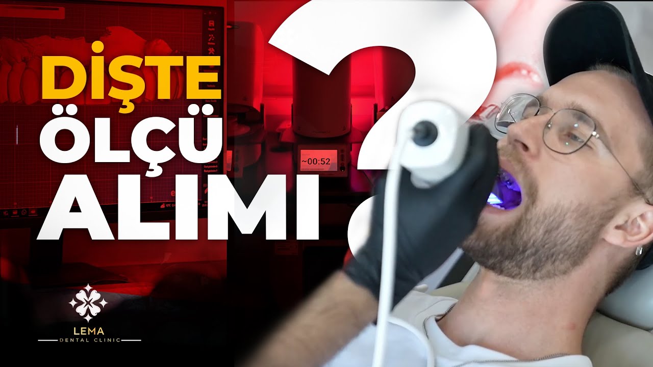 🤍 (с субтитрами) Как снять оттиск с зубов? - Стоматологическая клиника 
