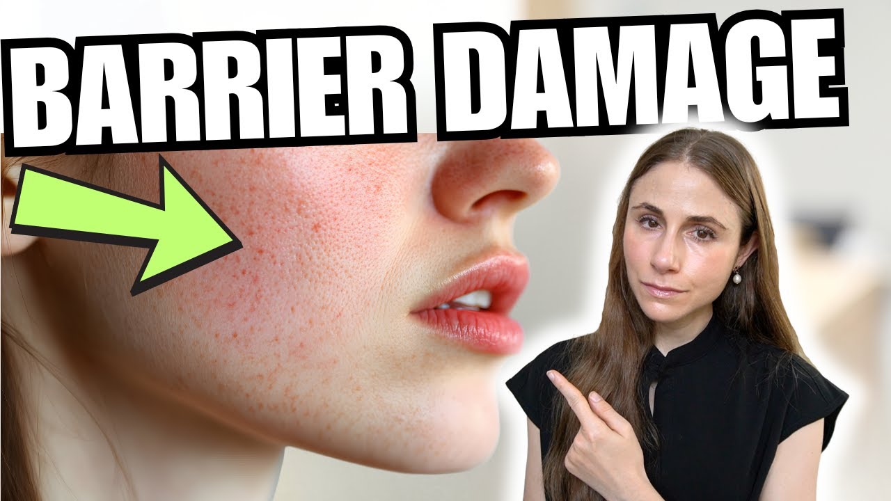 What Is Your Skin Barrier &mdash; And Why Should You Care?