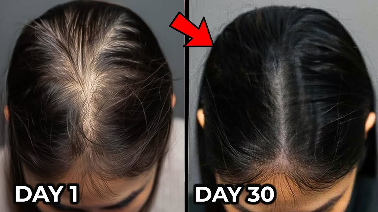 15 Amazing hair Growth/Grey hair hacks & tips!! 