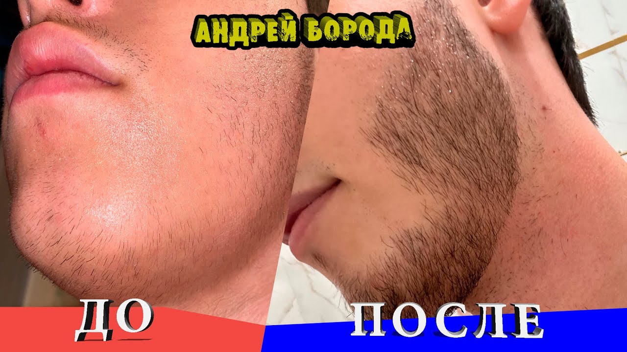 Зачем Роллер для Бороды / Минокс До и После / Андрей Борода / Выпуск № 14 