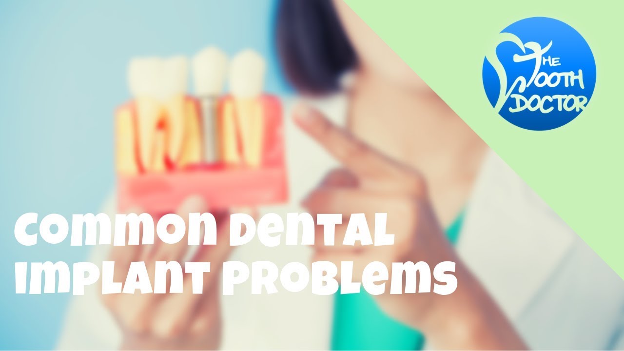 Ellerslie Dental  Common Dental Implant Problems