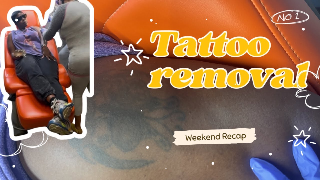 Tattoo Removal  