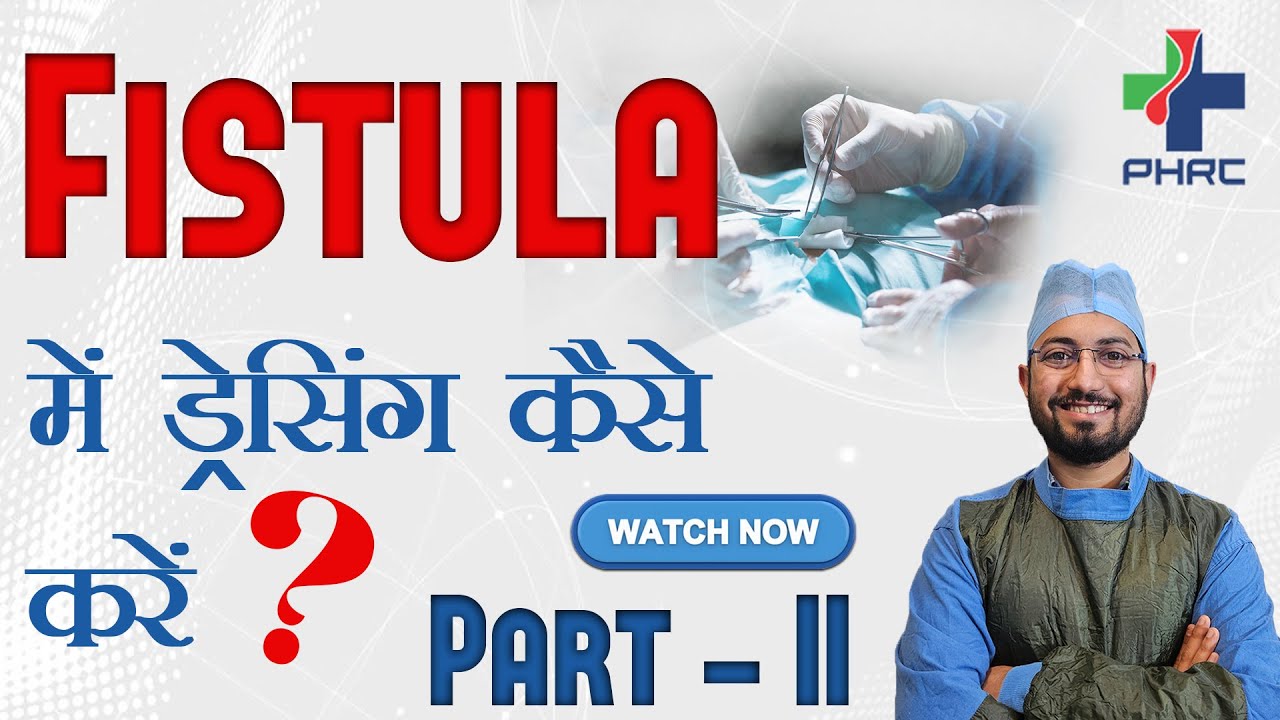 फिस्टुला में ड्रेसिंग कैसे करें? ( Part-II )  