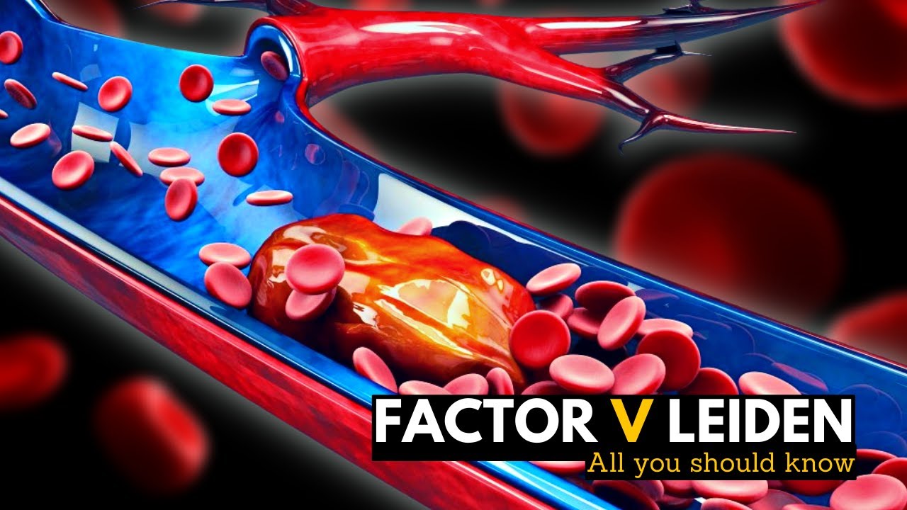 Factor V Leiden: Everything You Need To Know