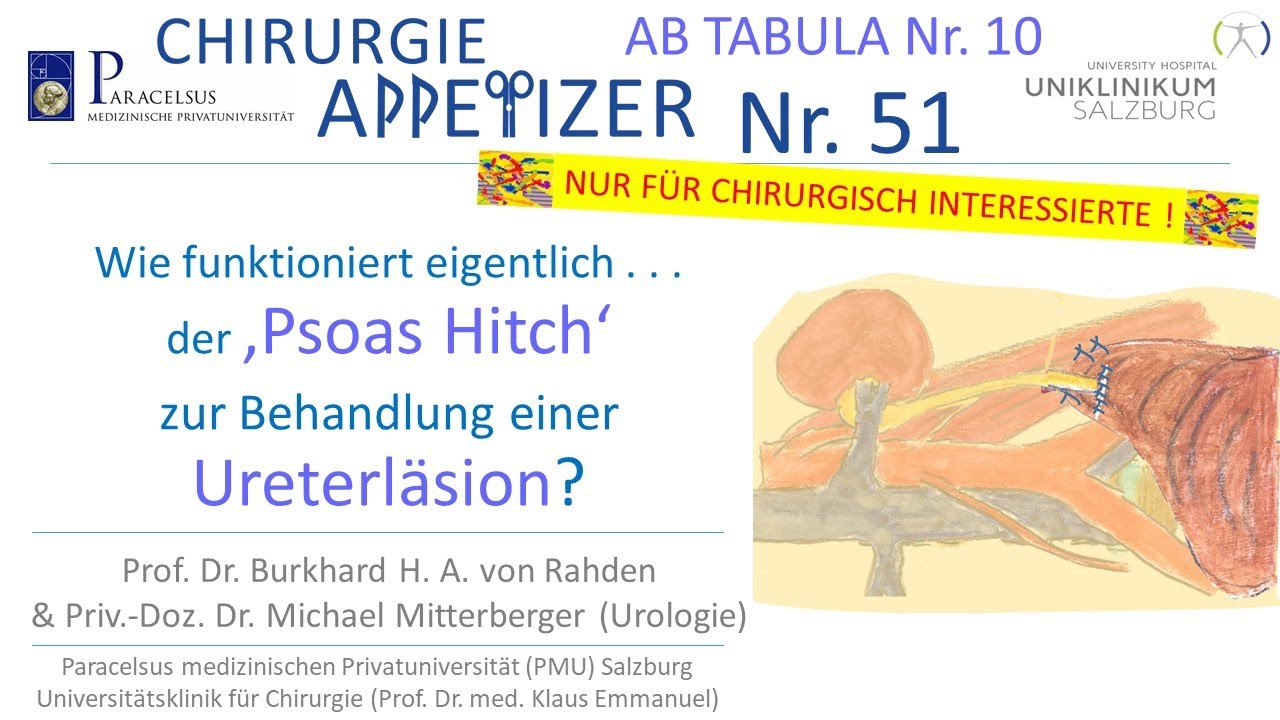 Wie funktioniert eigentlich &sbquo;Psoas Hitch&lsquo; bei Ureterl&auml;sion? CHIRURGIE APPetizer Nr.51 AB TABULA 10