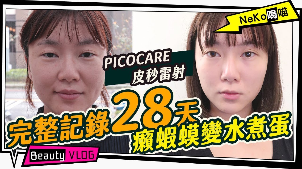 皮秒雷射Picocare不一樣！痘疤凹洞毛孔連黑眼圈都一併擊碎了！28天完整記錄｜NeKo嗚喵．醫美