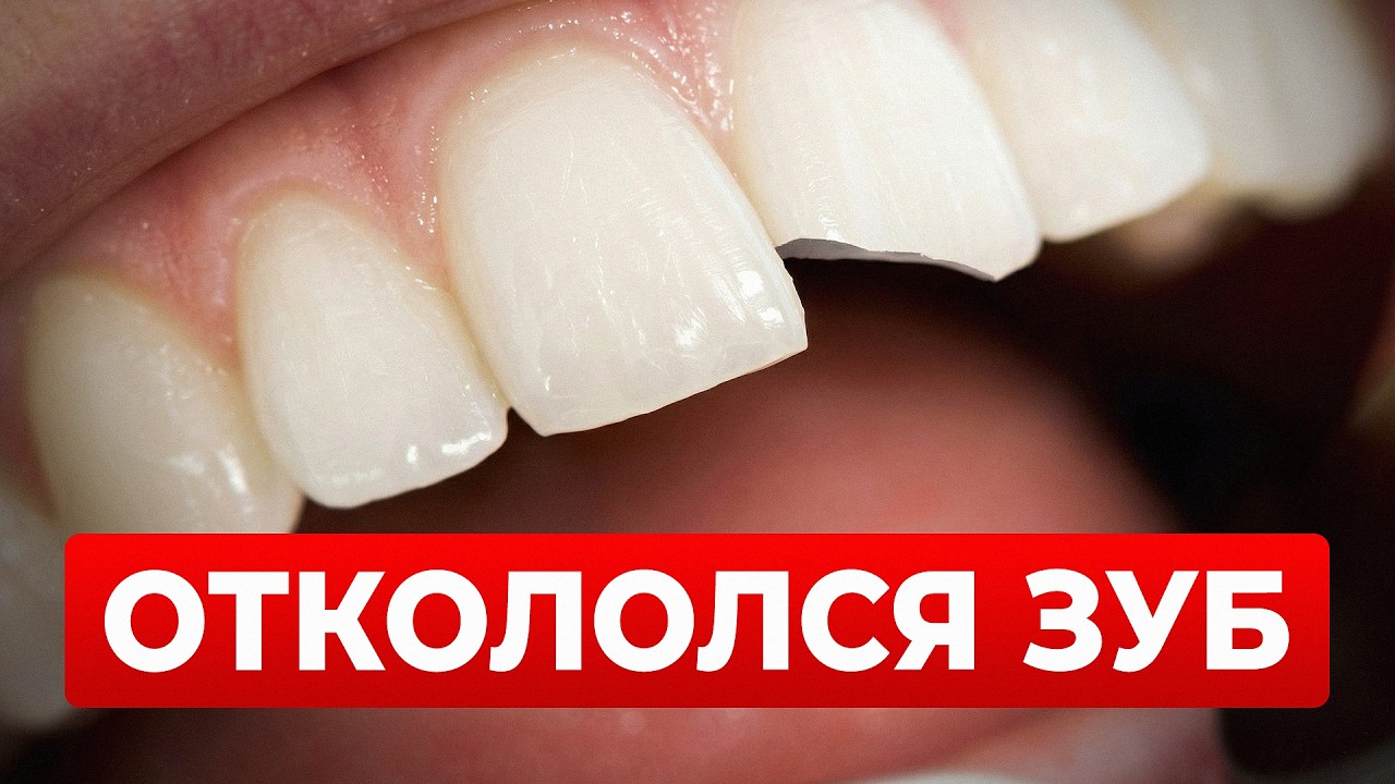 Откололся кусок зуба: ЛУЧШИЙ способ БЫСТРО восстановить!