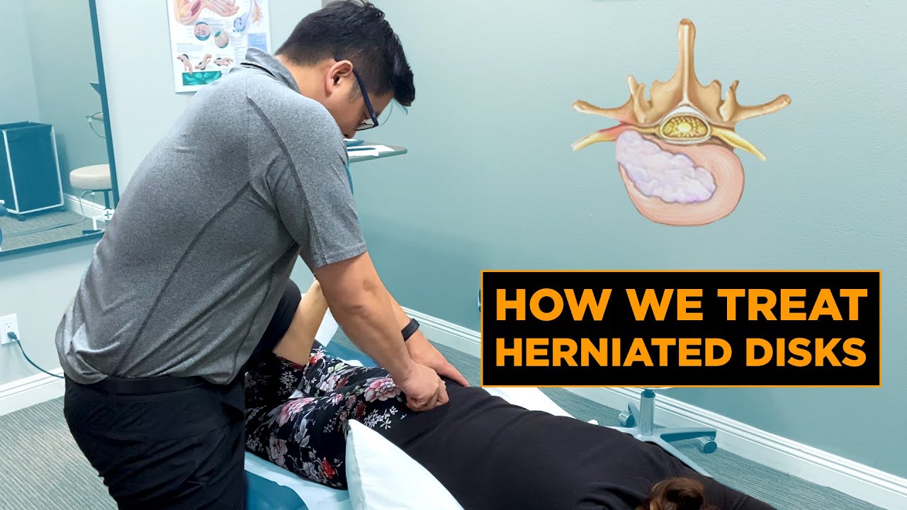 How We Treat a Herniated Disk | Physical Therapy