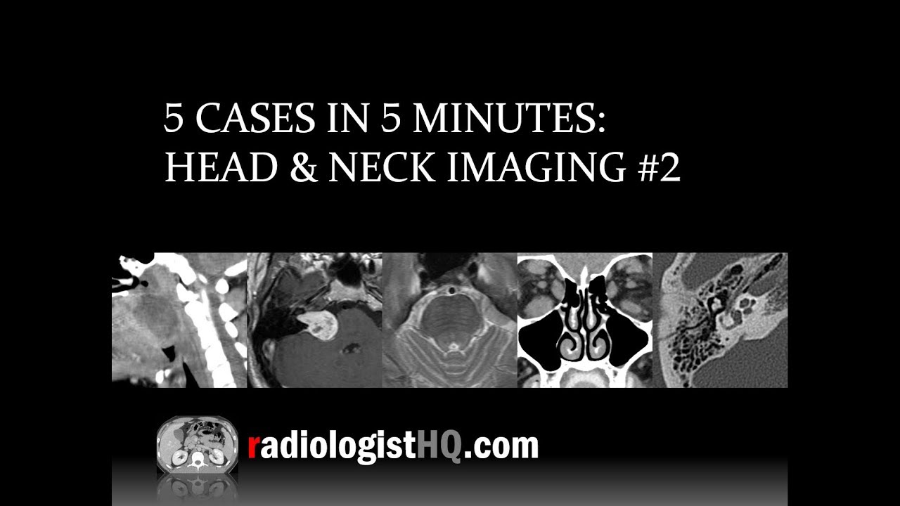 5 Cases in 5 Minutes: Head & Neck #2