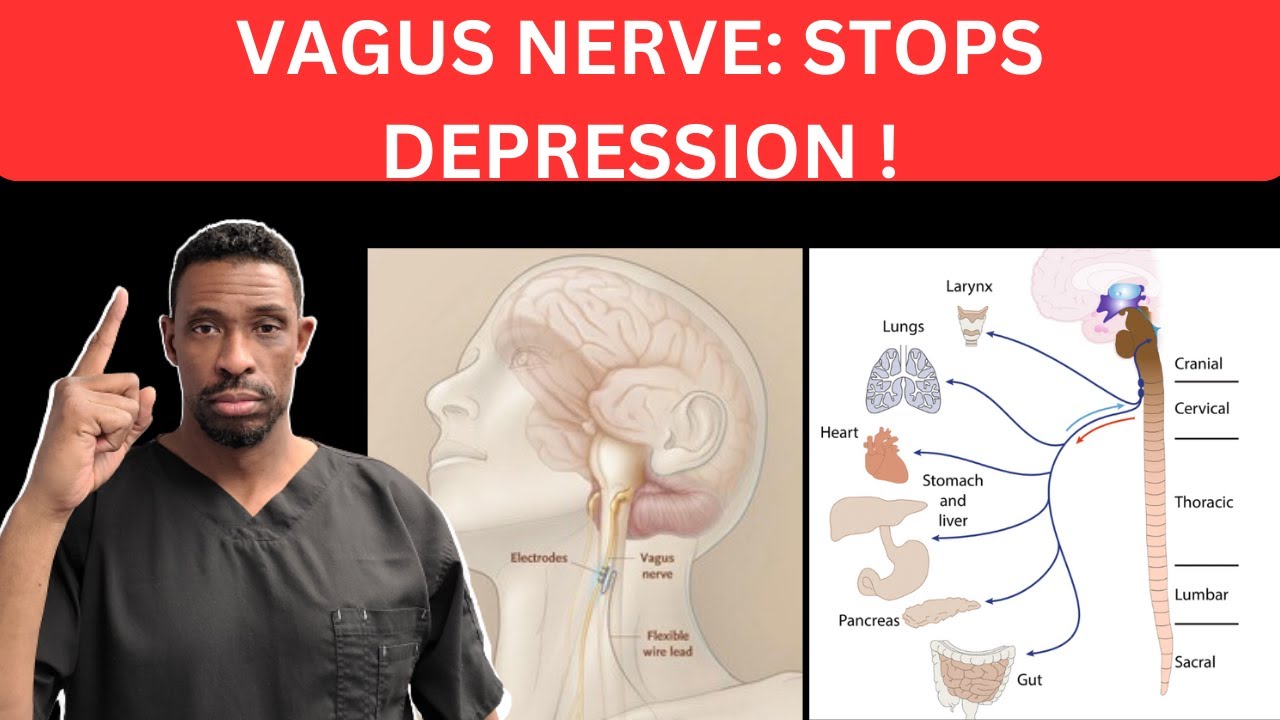 Vagus Nerve Stimulation : How It Can Help Permanently Stop Depression