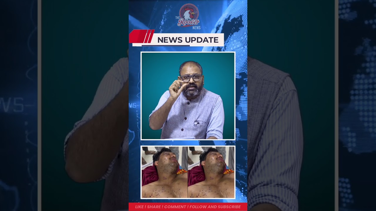 Pellet Guns Fired in Delhi? Victim Sahil Exposes Police Denial | CJP Protest