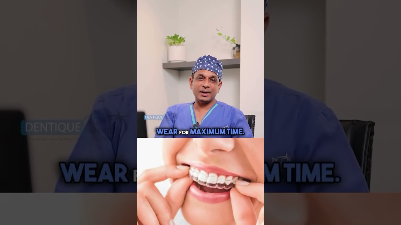 Ideal Wear Time for Clear Aligners | Teeth Aligners | Clear Aligner in Kerala 