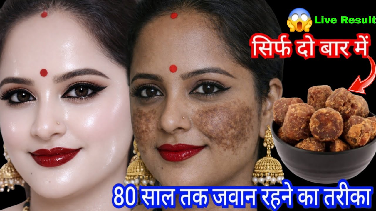 दो बूंद लगते ही मेरा चेहरा शीशे की तरह चमकने लगा👉10 साल पुरानी झाइयां काले दाग धब्बे सब साफ हो गए🙈