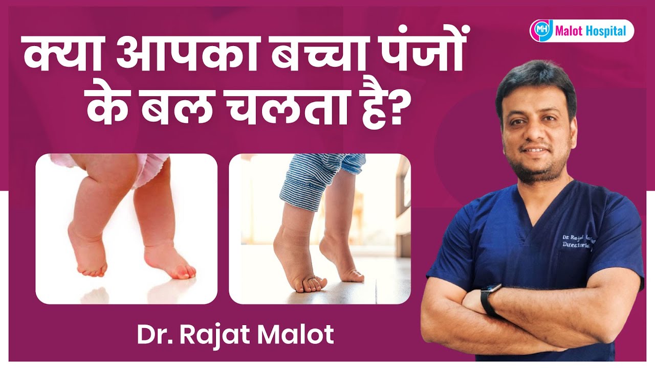 क्या आपका बच्चा पंजों के बल चलता है? जानिए इसका सही इलाज | Dr. Rajat Malot