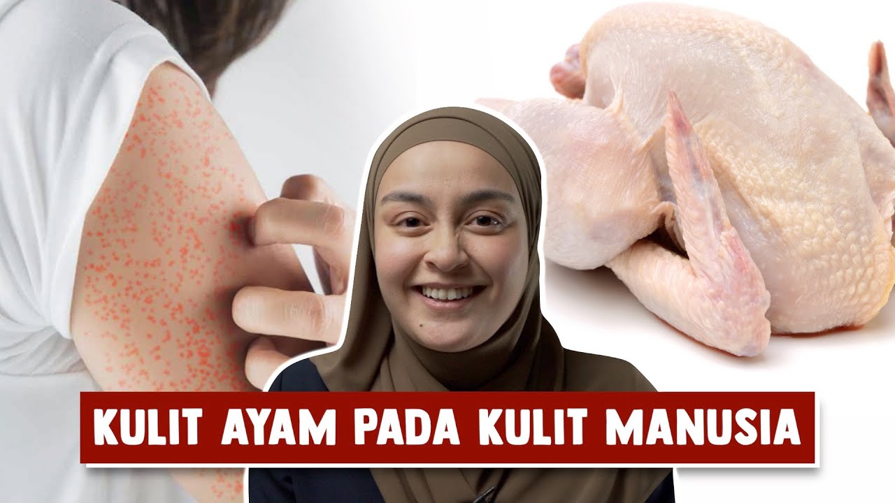 Kulit Ayam pada Kulit Manusia
