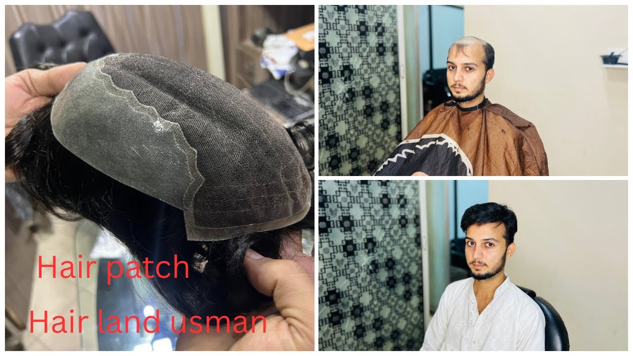 Q6 hair patch|natural looking hair patch|Hair land usman|03213219074