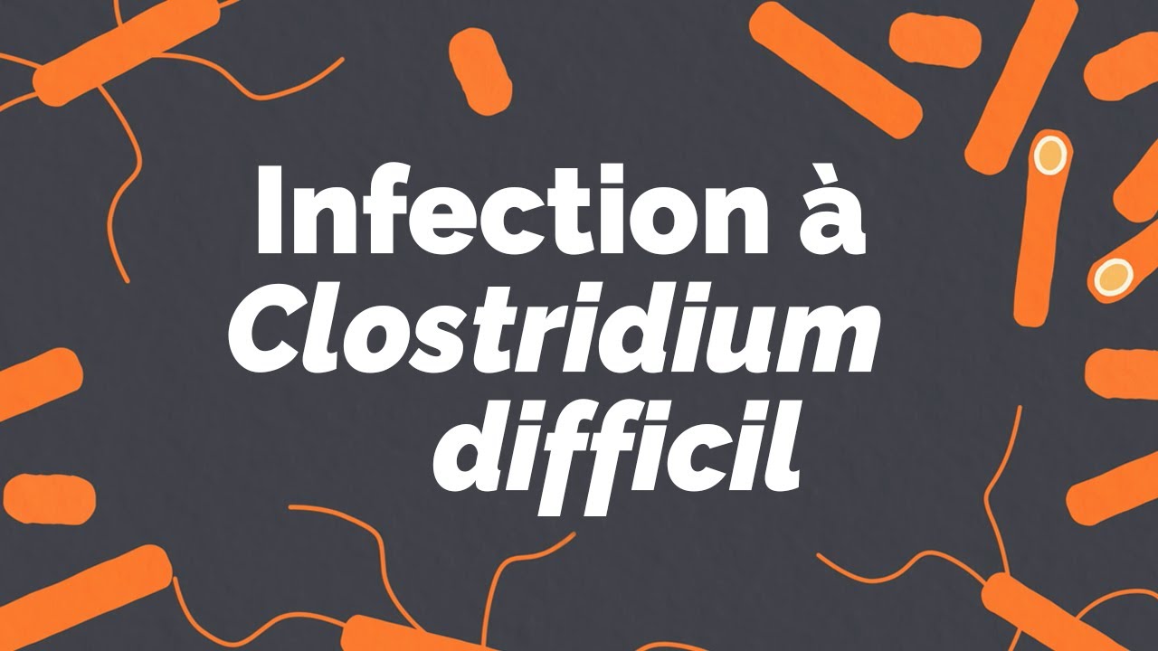 Infection à Clostridium difficile | Infection à Clostridioides difficile | Société GI